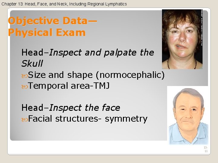 Chapter 13: Head, Face, and Neck, Including Regional Lymphatics Objective Data— Physical Exam Head–Inspect