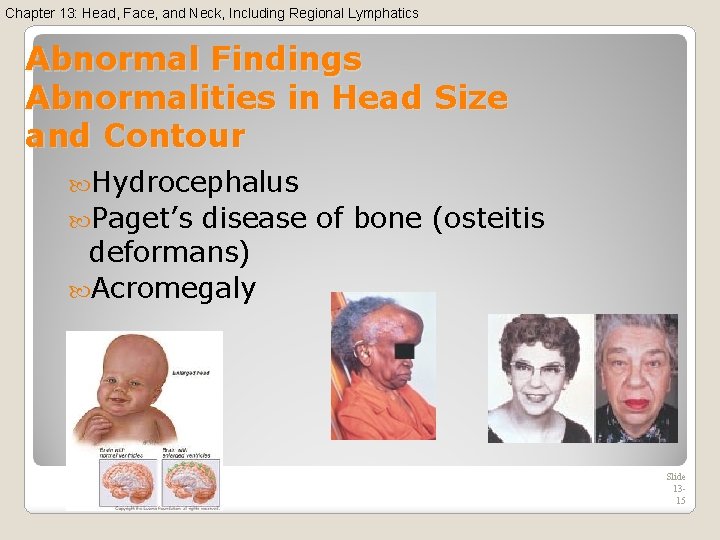 Chapter 13: Head, Face, and Neck, Including Regional Lymphatics Abnormal Findings Abnormalities in Head