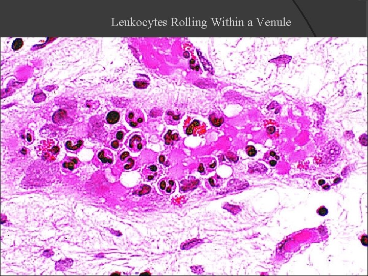 Leukocytes Rolling Within a Venule 