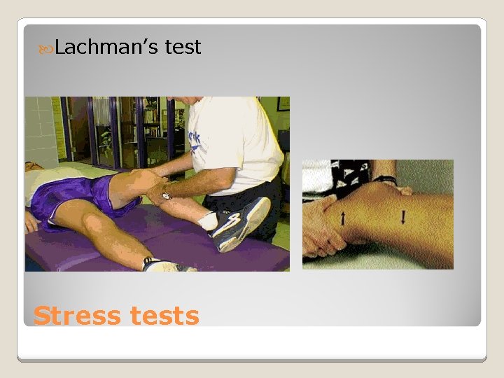  Lachman’s test Stress tests 