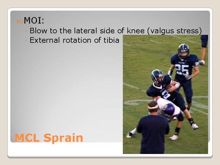  MOI: ◦ Blow to the lateral side of knee (valgus stress) ◦ External