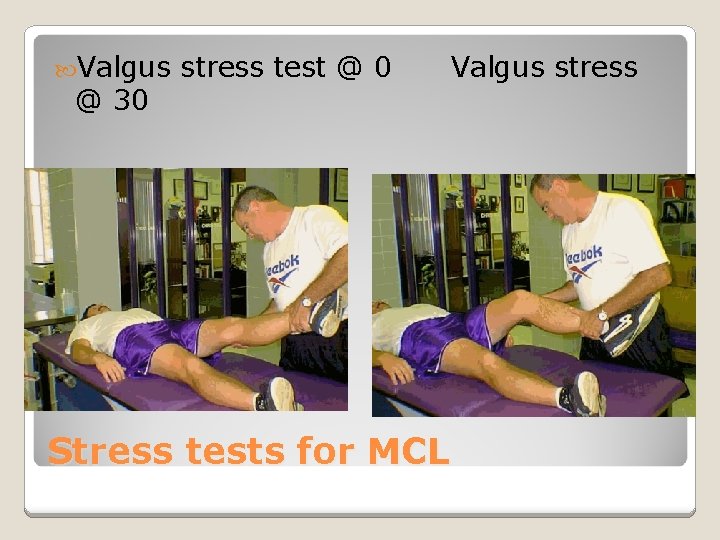  Valgus @ 30 stress test @ 0 Valgus stress Stress tests for MCL