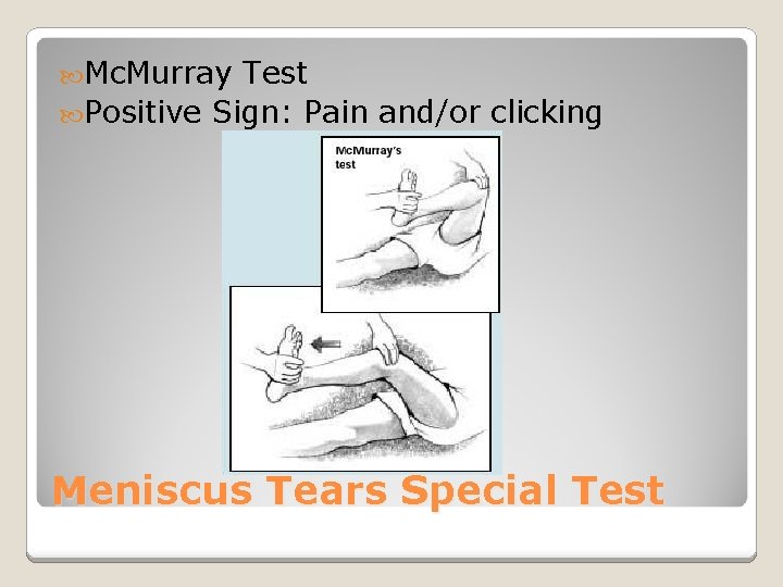  Mc. Murray Test Positive Sign: Pain and/or clicking Meniscus Tears Special Test 