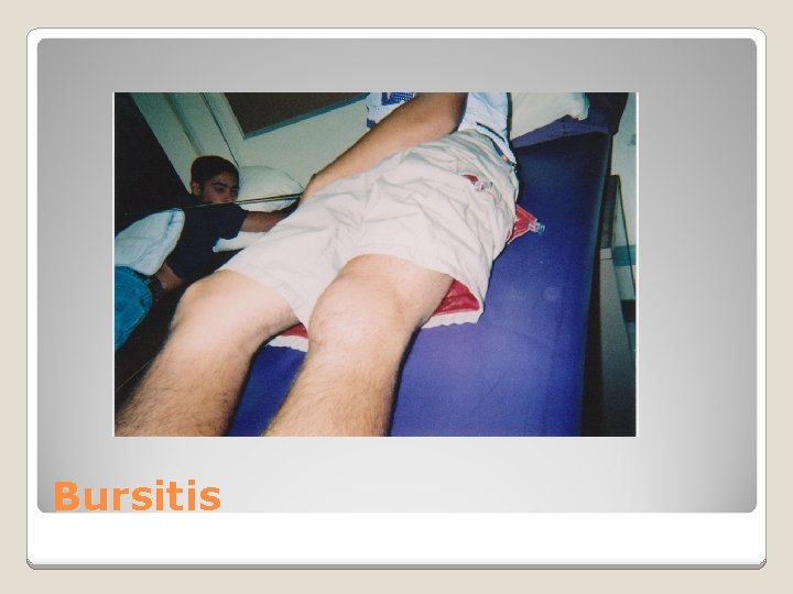 Bursitis 