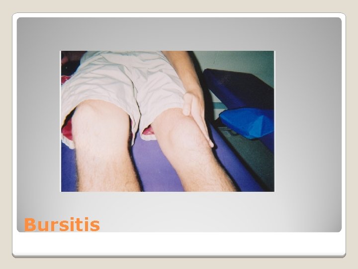 Bursitis 