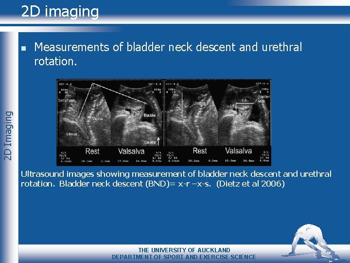 2 D imaging Measurements of bladder neck descent and urethral rotation. 2 D Imaging