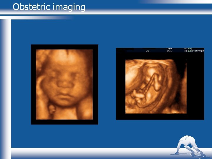 Obstetric imaging 