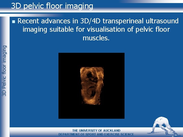 3 D pelvic floor imaging Recent advances in 3 D/4 D transperineal ultrasound imaging
