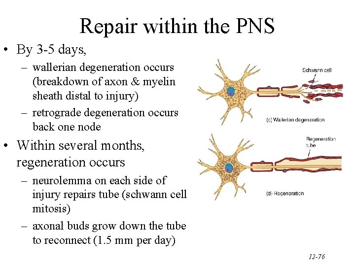 Repair within the PNS • By 3 -5 days, – wallerian degeneration occurs (breakdown