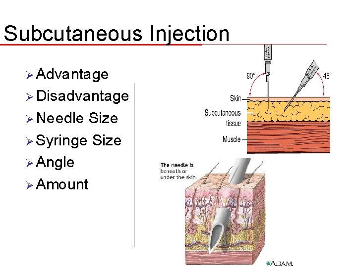Subcutaneous Injection Ø Advantage Ø Disadvantage Ø Needle Size Ø Syringe Size Ø Angle
