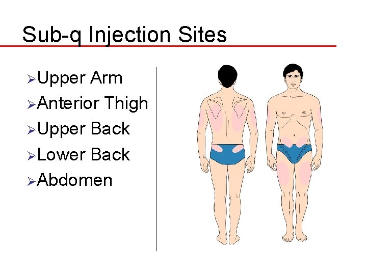 Sub-q Injection Sites ØUpper Arm ØAnterior Thigh ØUpper Back ØLower Back ØAbdomen 