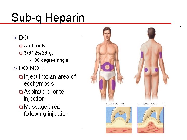 Sub-q Heparin Ø DO: Abd. only q 3/8” 25/26 g. q ü Ø 90