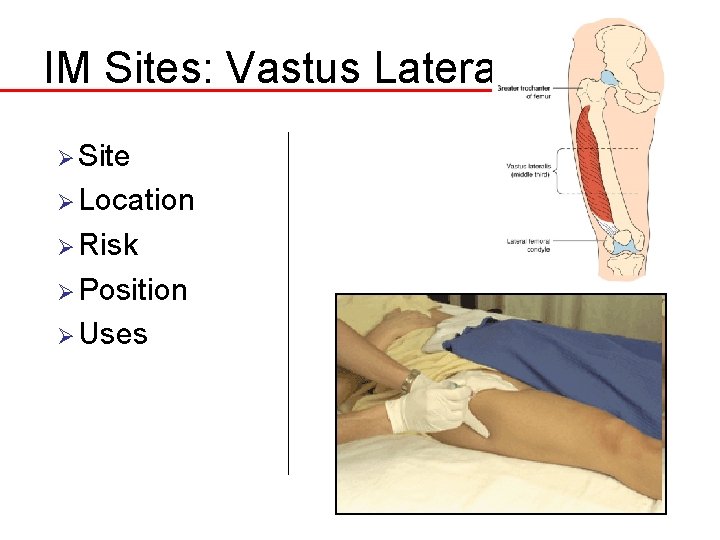 IM Sites: Vastus Lateralis Ø Site Ø Location Ø Risk Ø Position Ø Uses