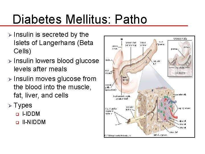 Diabetes Mellitus: Patho Insulin is secreted by the Islets of Langerhans (Beta Cells) Ø
