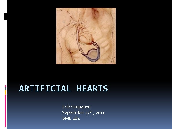 ARTIFICIAL HEARTS Erik Simpanen September 27 th , 2011 BME 281 