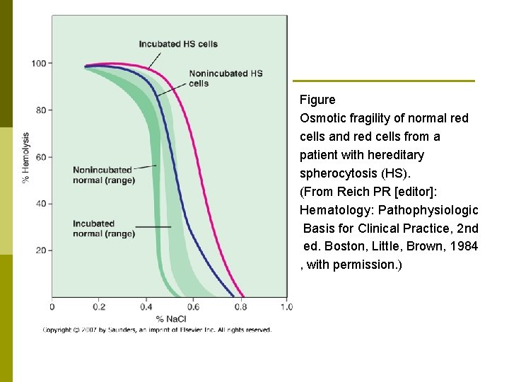 Figure Osmotic fragility of normal red cells and red cells from a patient with