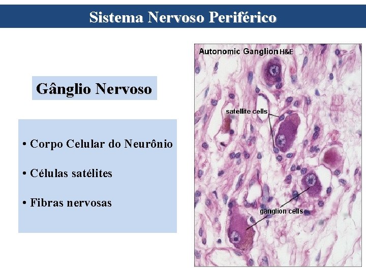 Sistema Nervoso Periférico Gânglio Nervoso • Corpo Celular do Neurônio • Células satélites • Sistema Nervoso Periférico Gânglio Nervoso • Corpo Celular do Neurônio • Células satélites •