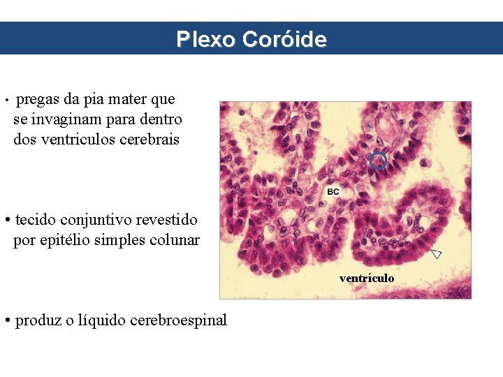 Plexo Coróide • pregas da pia mater que se invaginam para dentro dos ventriculos