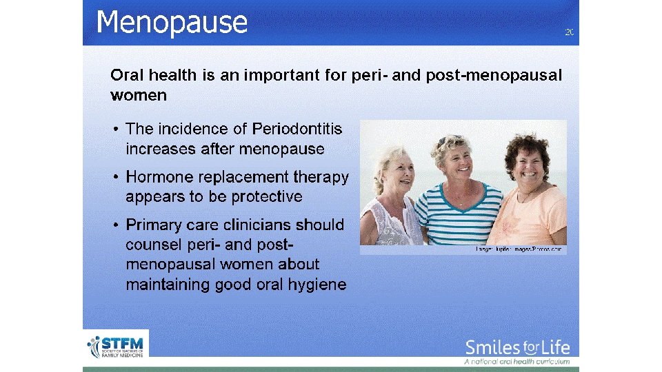 Menopause 20 