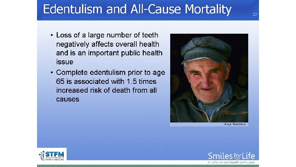 Edentulism and All-Cause Mortality Image: Punchstock 23 
