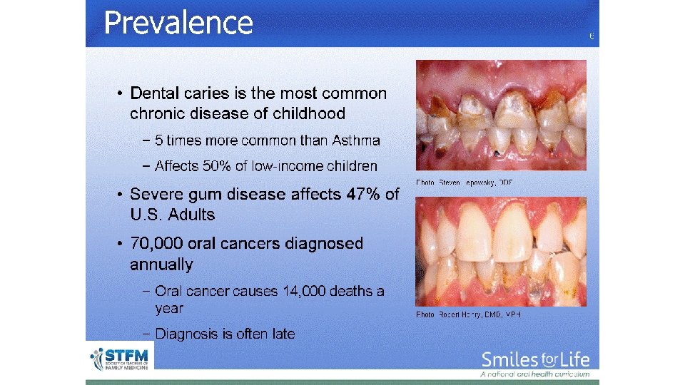 Prevalence 6 Photo: Steven Lepowsky, DDS Photo: Robert Henry, DMD, MPH 