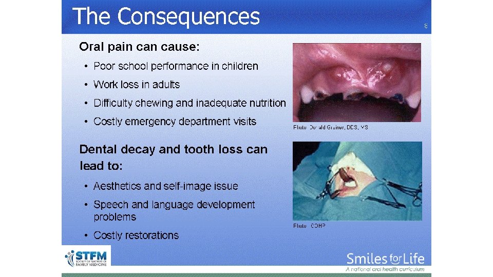 The Consequences 8 Photo: Donald Greiner, DDS, MS Photo: ICOHP 