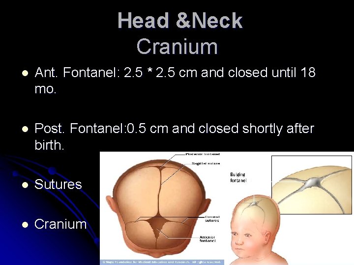 Head &Neck Cranium l Ant. Fontanel: 2. 5 * 2. 5 cm and closed Head &Neck Cranium l Ant. Fontanel: 2. 5 * 2. 5 cm and closed
