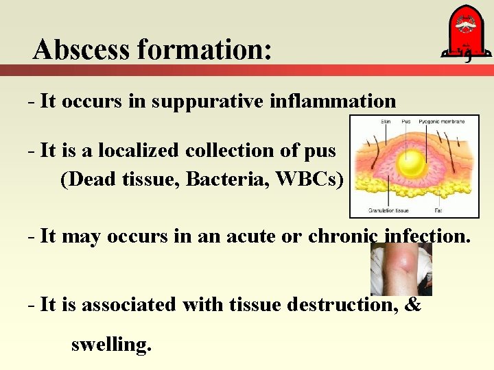 Abscess formation: - It occurs in suppurative inflammation - It is a localized collection Abscess formation: - It occurs in suppurative inflammation - It is a localized collection