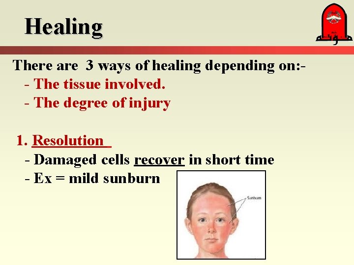Healing There are 3 ways of healing depending on: - The tissue involved. - Healing There are 3 ways of healing depending on: - The tissue involved. -