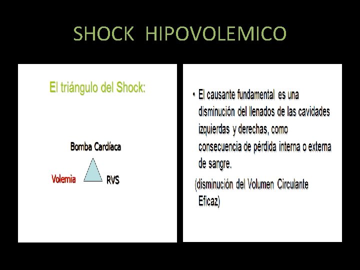 SHOCK HIPOVOLEMICO 