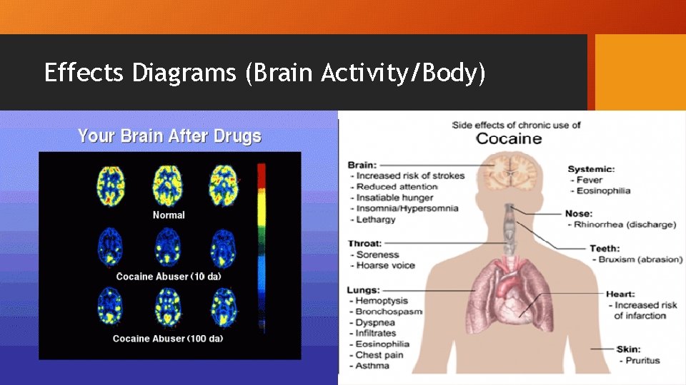 Effects Diagrams (Brain Activity/Body) 