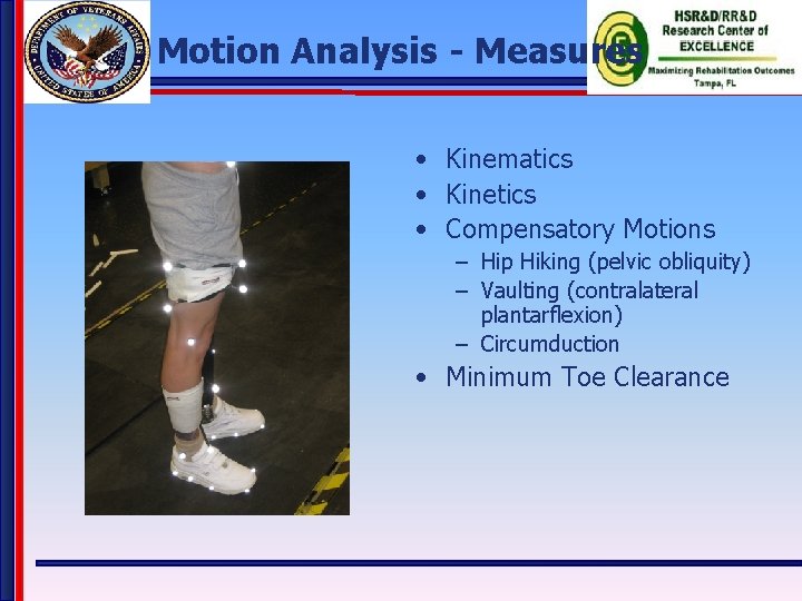 Motion Analysis - Measures • Kinematics • Kinetics • Compensatory Motions – Hip Hiking