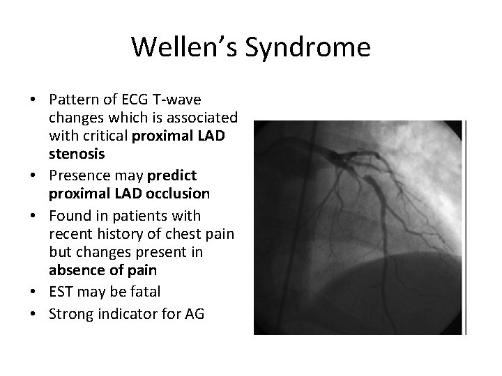 Wellen’s Syndrome • Pattern of ECG T-wave changes which is associated with critical proximal