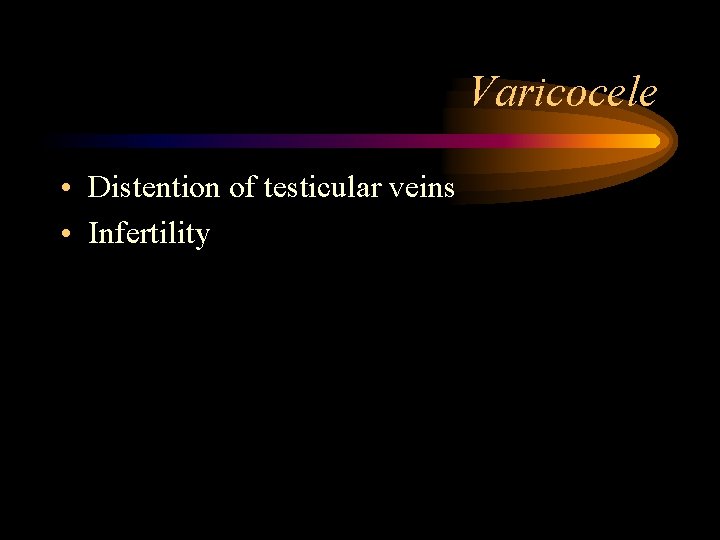 Varicocele • Distention of testicular veins • Infertility 