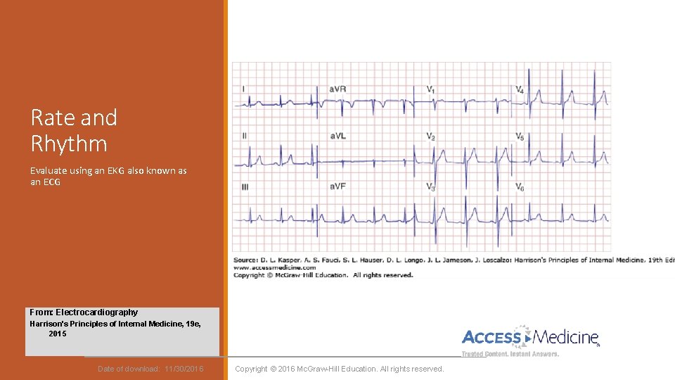 Rate and Rhythm Evaluate using an EKG also known as an ECG From: Electrocardiography