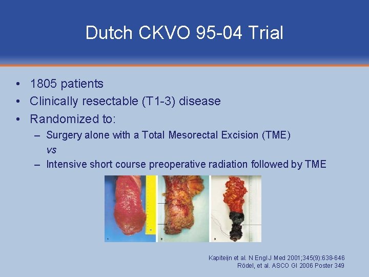 Dutch CKVO 95 -04 Trial • 1805 patients • Clinically resectable (T 1 -3)