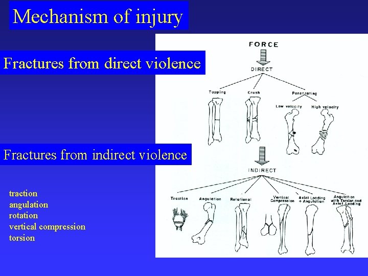 Mechanism of injury Fractures from direct violence Fractures from indirect violence traction angulation rotation