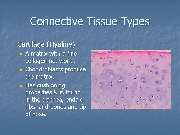 Connective Tissue Types Cartilage (Hyaline) n n n A matrix with a fine collagen