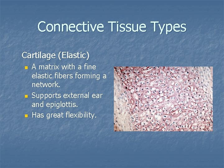 Connective Tissue Types Cartilage (Elastic) n n n A matrix with a fine elastic
