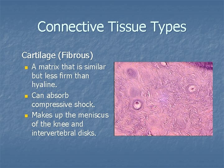 Connective Tissue Types Cartilage (Fibrous) n n n A matrix that is similar but