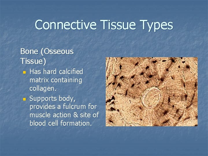 Connective Tissue Types Bone (Osseous Tissue) n n Has hard calcified matrix containing collagen.