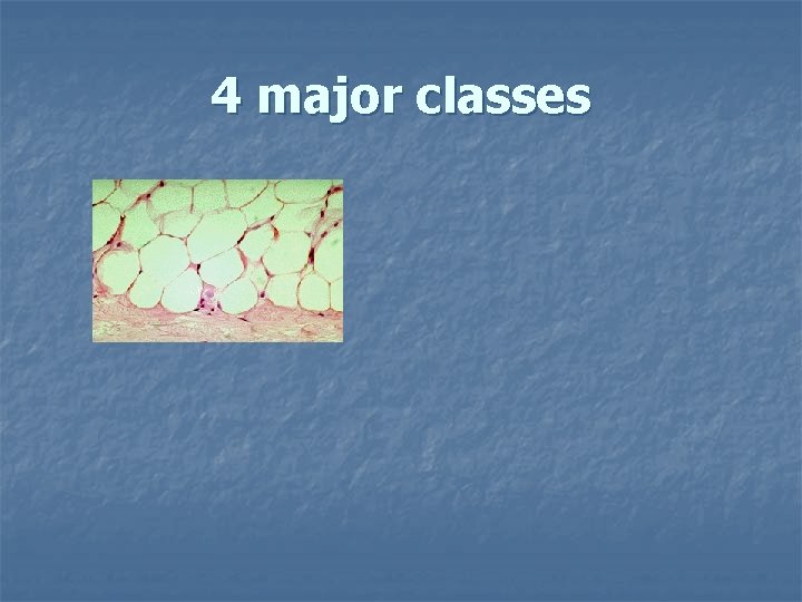 4 major classes 