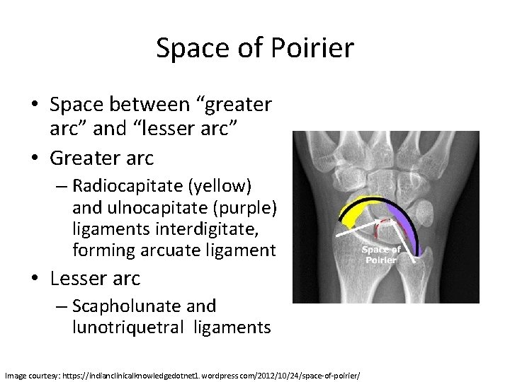 Space of Poirier • Space between “greater arc” and “lesser arc” • Greater arc