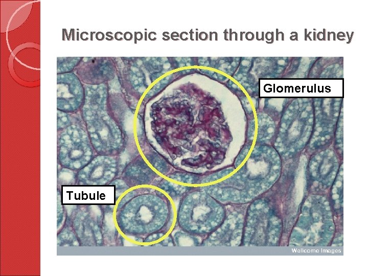 Microscopic section through a kidney Glomerulus Tubule 