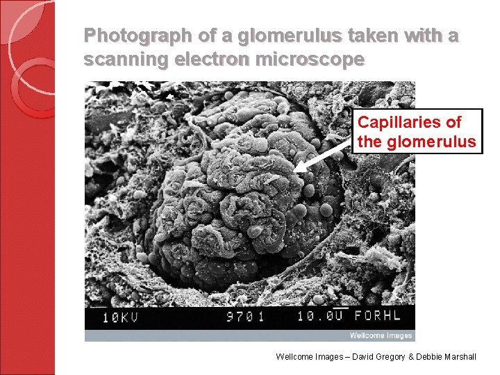 Photograph of a glomerulus taken with a scanning electron microscope Capillaries of the glomerulus