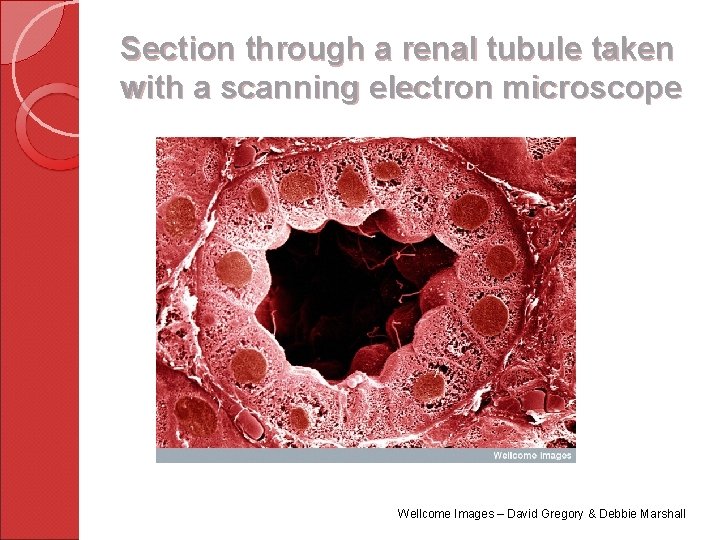 Section through a renal tubule taken with a scanning electron microscope Wellcome Images –