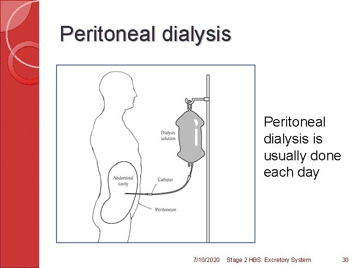 Peritoneal dialysis is usually done each day 7/10/2020 Stage 2 HBS: Excretory System 30