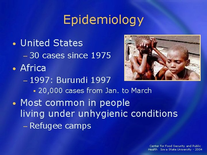 Epidemiology • United States − 30 • cases since 1975 Africa − 1997: §