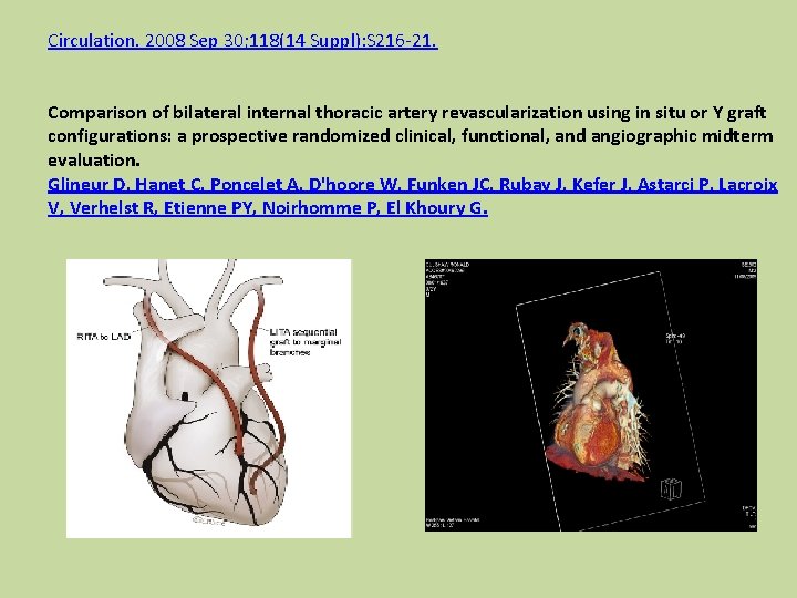 Circulation. 2008 Sep 30; 118(14 Suppl): S 216 -21. Comparison of bilateral internal thoracic