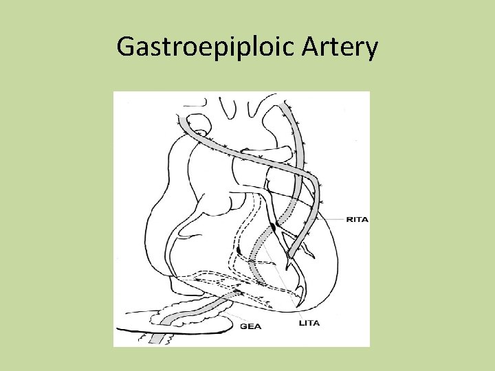 Gastroepiploic Artery 